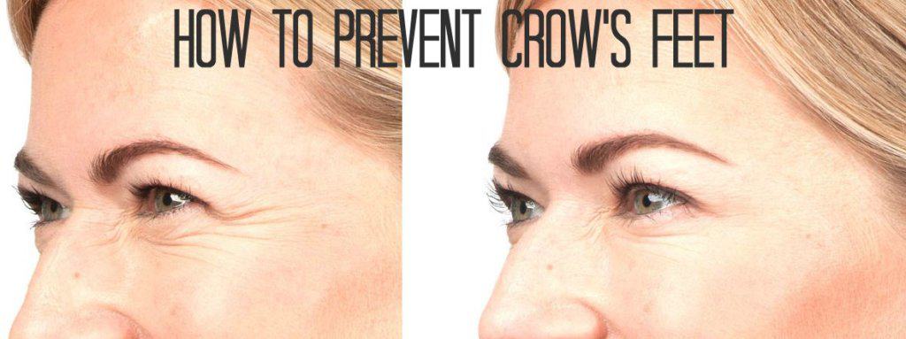 How to-prevent-crows-feet | South Ogden, UT | Timeless Skin and Wellness