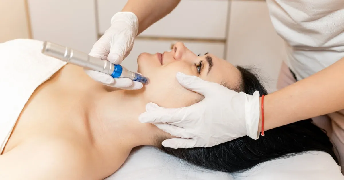 Women receiving Microneedling vs. RF Microneedling in South Ogden UT, Utah