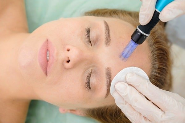 Microneedling Ogden UT – Answers From the Experts | South Ogden, UT | Timeless Skin and Wellness