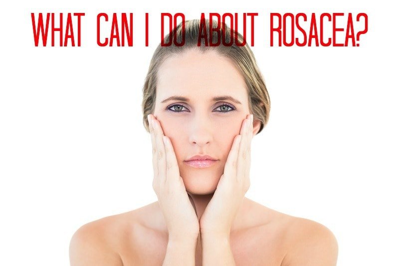 What Can I do about Rosacea? | South Ogden, UT | Timeless Skin and Wellness